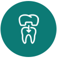 dental bridges