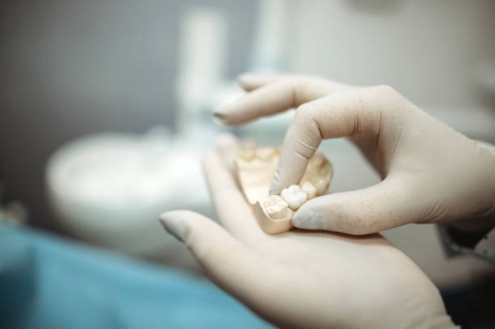 dental crowns
